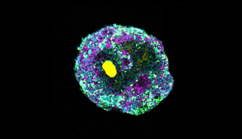 Organoide retinal com uma esfera microscopicamente pequena de DNA (amarelo) e vários r