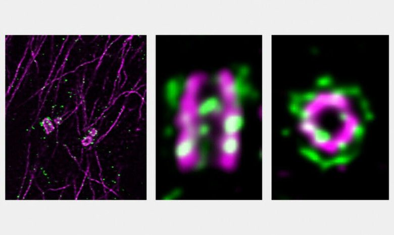 Imagem de microscopia mostrando dois centrossomas e microtúbulos em células humanas (esquerda).