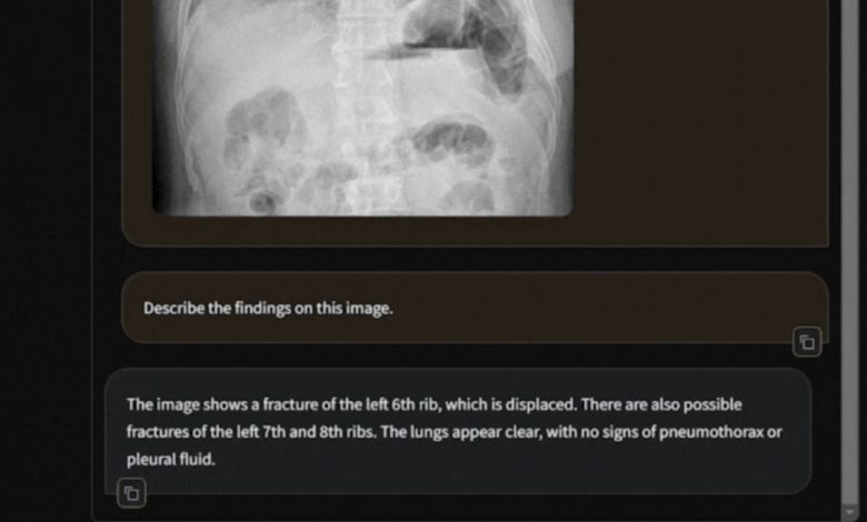 Harrison.ai apresenta radiologia genAI e mais resumos de IA