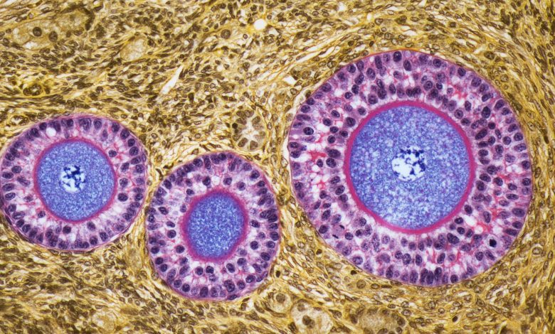 Imagem microscópica de folículos ovarianos. Três círculos anelados manchados de rosa e roxo são cercados por tecido manchado de amarelo.