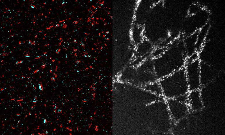 Graças a uma nova técnica que lhes permite expandir o tecido 20 vezes antes da imagem