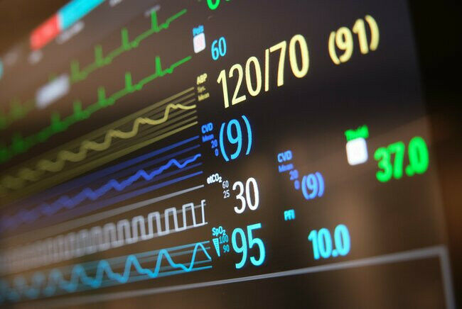 Informações do paciente em um monitor. Imagem: Hospital Catharina