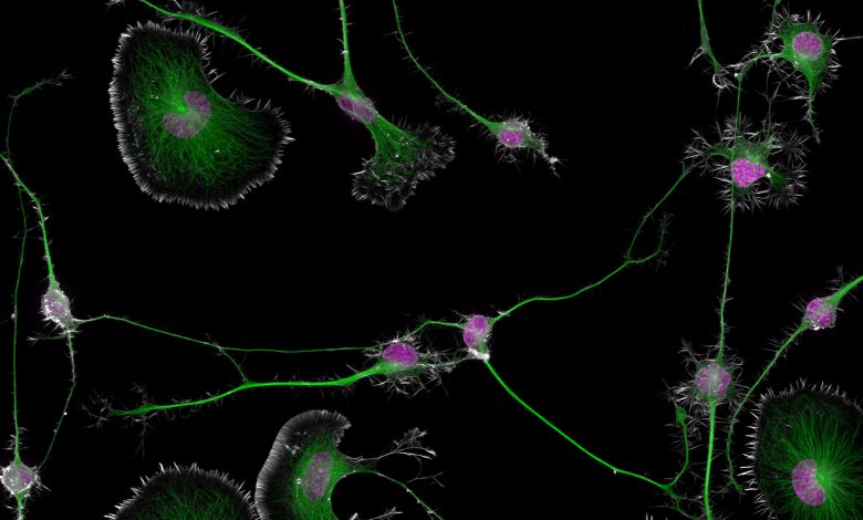 Células tumorais cerebrais diferenciadas de camundongos (actina, microtúbulos e núcleos)